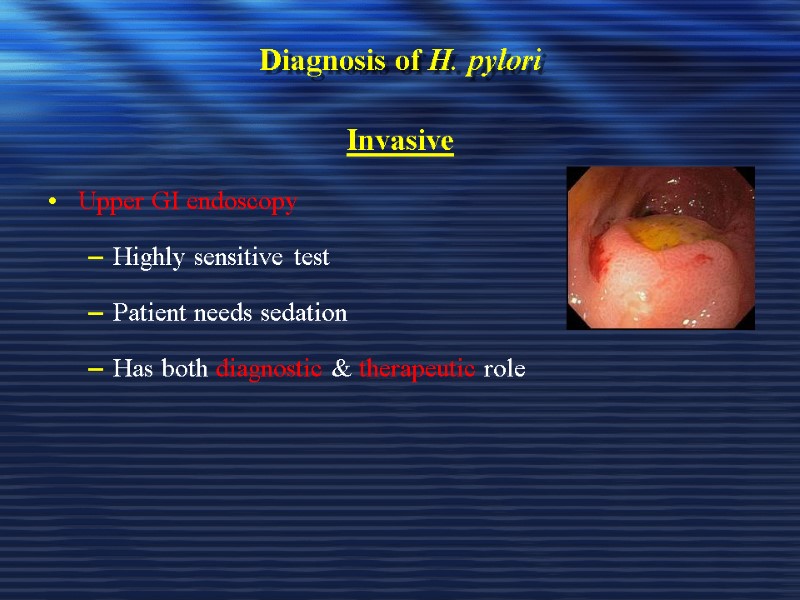 Diagnosis of H. pylori Invasive Upper GI endoscopy Highly sensitive test Patient needs sedation